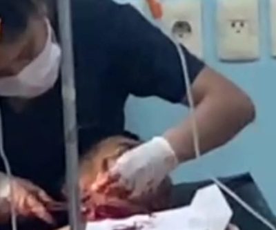 Mujer hiere con vidrio roto a un joven