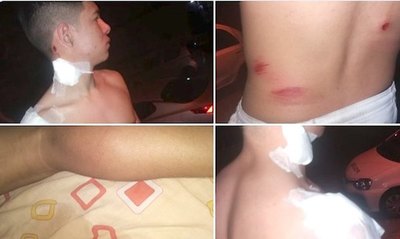 Crónica / Mitã’i fueron heridos tras final ¿por polis?