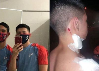 Denuncian brutal agresión policial a adolescentes tras partido de Cerro Porteño - Noticiero Paraguay