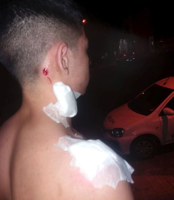 Identifican y están bajo sumario los dos policías vinculados a agresión a pasapelotas - Nacionales - ABC Color