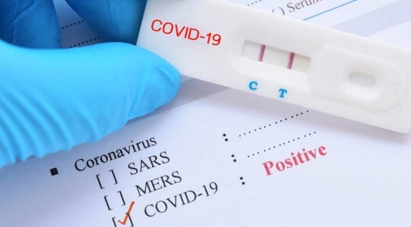 HOY / OMS aprueba tests rápidos que permiten detectar casos de COVID-19 en 15 minutos