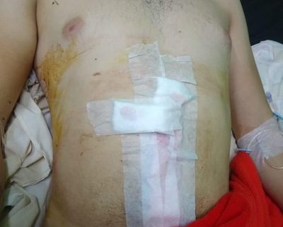 Joven permanece hospitalizado tras ser herido de una apuñalada por su padrastro – Diario TNPRESS