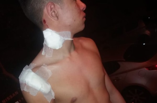 Comando policial aplica sumario a policías que agredieron a pasapelotas - ADN Paraguayo