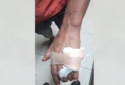 Crónica / Dos tilingos casi lo matan a machetazos