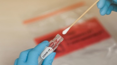 Desarrollan un detector que mide la carga viral de COVID-19 en minutos » Ñanduti