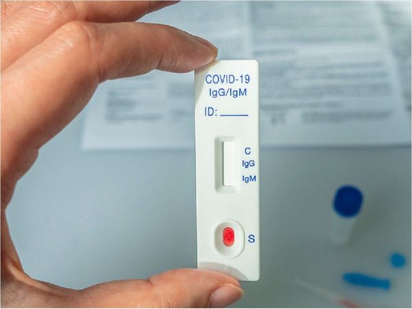 Setiembre termina con promedio de 760 contagios nuevos por día