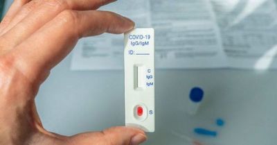 Setiembre termina con promedio de 760 contagios nuevos por día