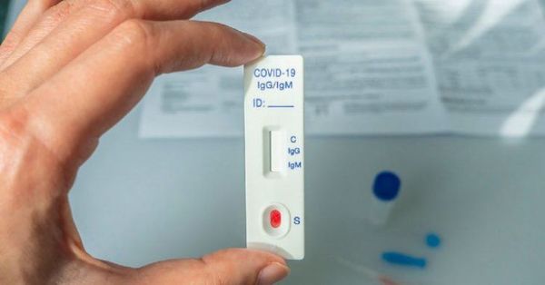 Setiembre termina con promedio de 760 contagios nuevos por día