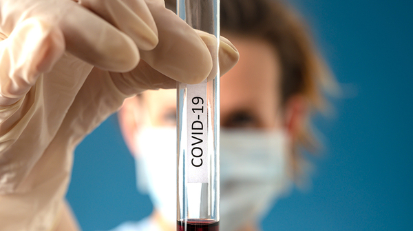 COVID-19: Un análisis de sangre detectaría riesgo de morir por coronavirus. | OnLivePy
