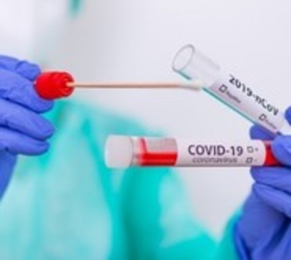 Coronavirus: 18 nuevas víctimas fatales y más de 600 recuperados  - Paraguay.com