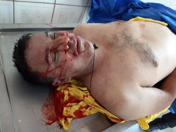 Ecuatoriano muere tras ser atacado por sicarios en Pedro Juan Caballero
