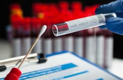 Hombre vuelve a dar positivo por Covid-19 meses después de haberse contagiado - C9N