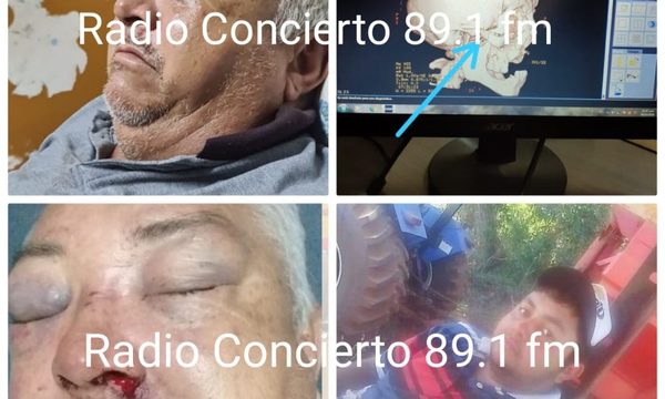 Desalmado joven casi mata a golpes a su papá