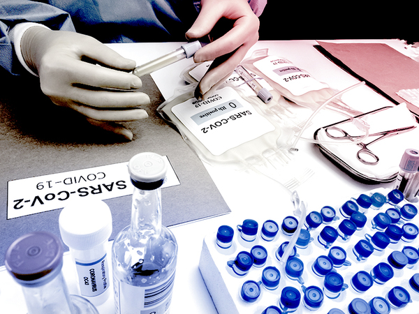 Crean un nuevo tipo de test sanguíneo preciso de anticuerpos COVID-19. | OnLivePy