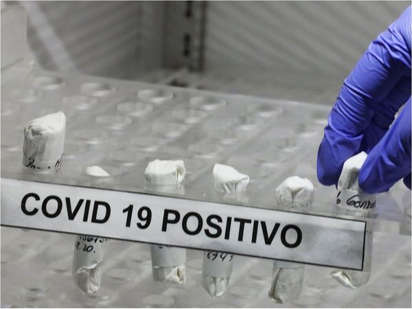 Confirman primer caso de Covid-19 e influenza en una misma persona