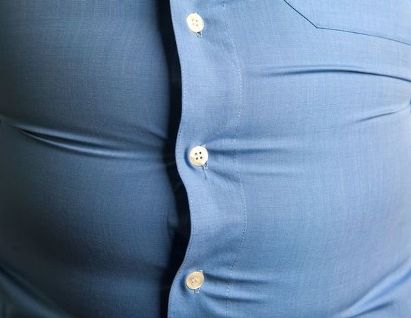 Obesidad afecta más a los sectores más desfavorecidos, reconoce experta - Mundo - ABC Color