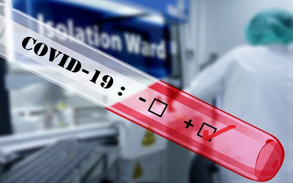 ¡19 muertos por coronavirus y más de 50 mil positivos en Ñande Retã!