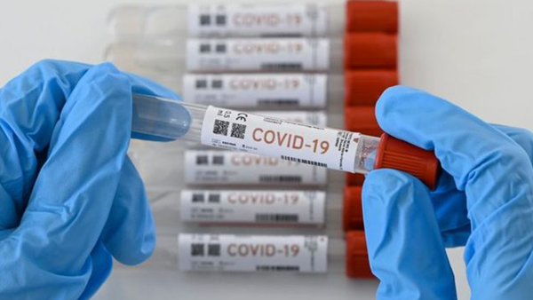 Una anciana de los Países Bajos, la primera muerte por reinfección de COVID-19 en el mundo