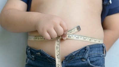 Estadísticas indican que Paraguay es el país con más alto porcentaje de niños con obesidad