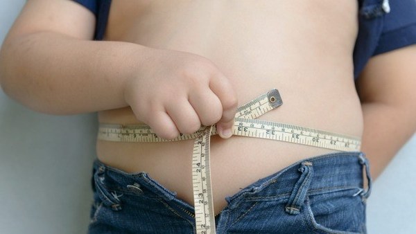Estadísticas indican que Paraguay es el país con más alto porcentaje de niños con obesidad