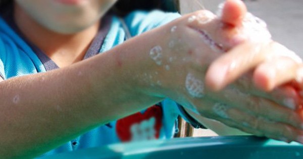 La Nación / El coronavirus sobrevive en la piel cinco veces más que la gripe, según un estudio