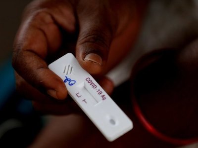 Se roza los 40 millones de casos de Covid, con 1,1 millones de muertes