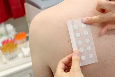 Señales de alergia de contacto en niños - Estilo de vida - ABC Color