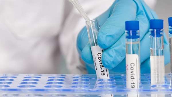 Reportan 19 nuevos fallecidos por coronavirus | Noticias Paraguay