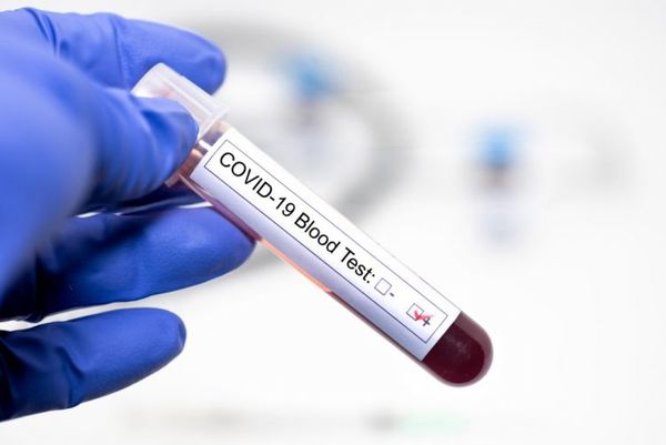 Salud reporta 19 fallecidos y 746 nuevos contagios por coronavirus