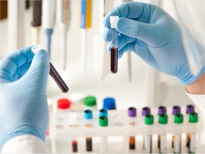 Fármaco para leucemia da resultados positivos en primer ensayo