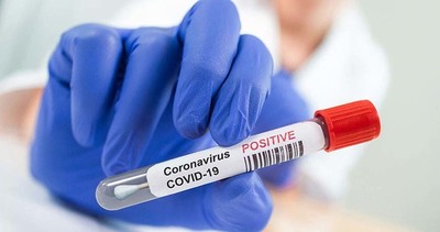 Covid-19: El día cierra con 12 fallecidos y 707 positivos