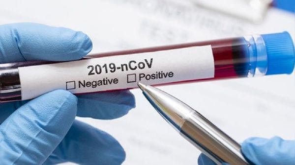 Coronavirus: Argentina duplicó la mortalidad en los últimos 31 días » Ñanduti