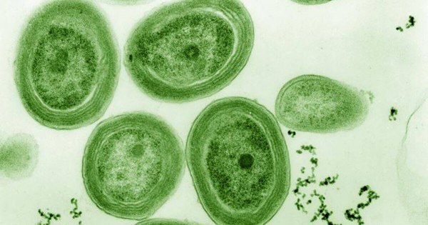 La Nación / Lago Ypacaraí en terapia intensiva: analizan estrategias para mitigar las cianobacterias