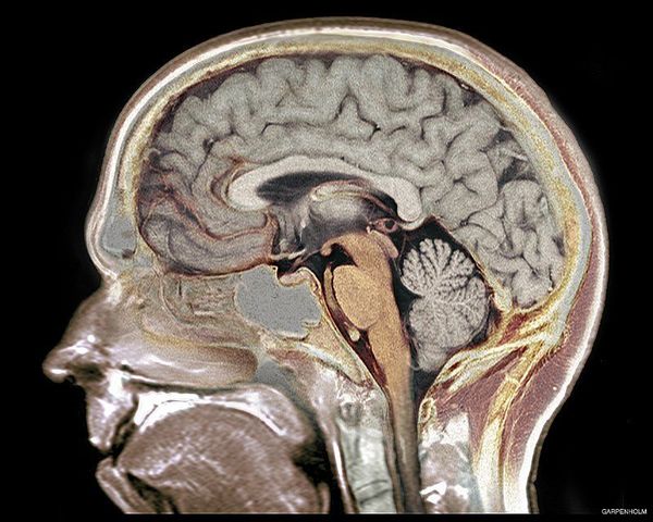 Revelan mecanismos de la red de neuronas que regulan el sueño y la vigilia » Ñanduti