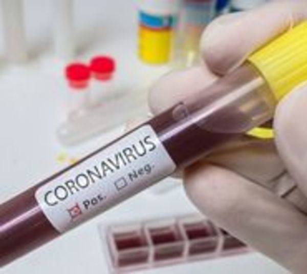 15 fallecidos por coronavirus este sábado - Paraguay.com