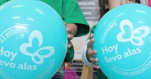 La Nación / Piel de mariposa: trabajan hace años para dar batalla a la enfermedad