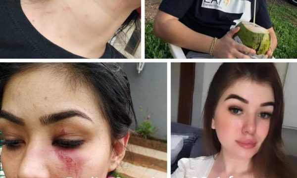 Dos jóvenes son brutalmente golpeadas durante fiesta en Ciudad Nueva