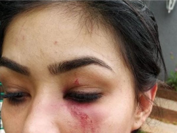 Denuncian que fueron agredidas por cuatro mujeres en un baño