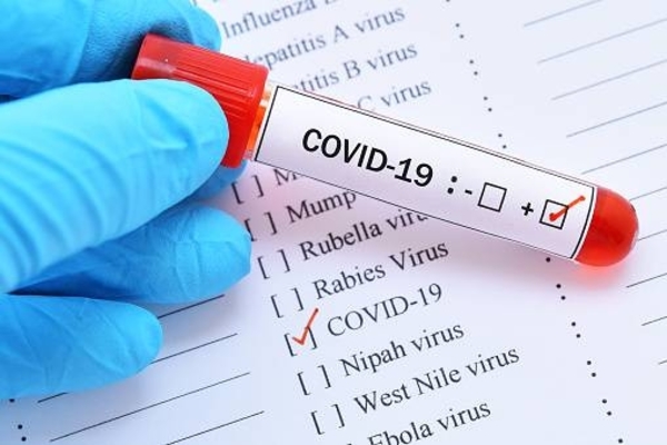 HOY / Capiatá: Disponen cierre temporal en sede de la ANDE por casos de COVID-19