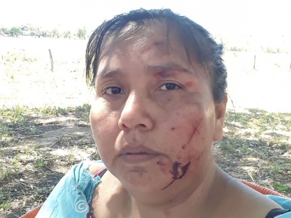 Líder indígena fue agredida por orden de otros caciques