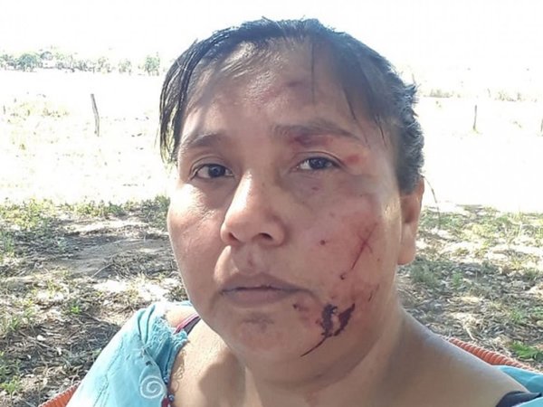 Agreden a lideresa Toba Qom en conflicto por plantación en tierras indígenas