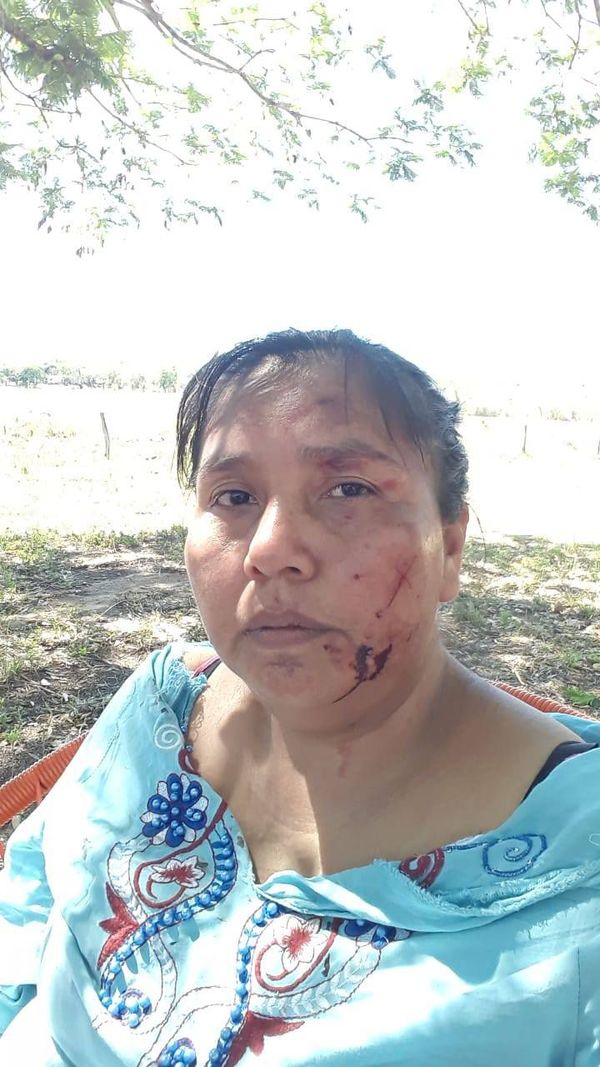 Conflicto en comunidad indígena por cultivo de eucalipto terminó en agresión a una lideresa  - Nacionales - ABC Color