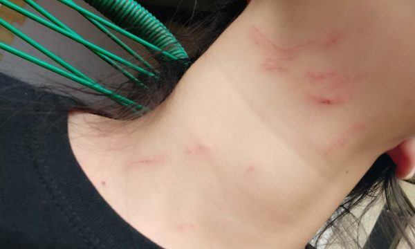 Dos mujeres sufren una paliza en fiesta privada – Diario TNPRESS