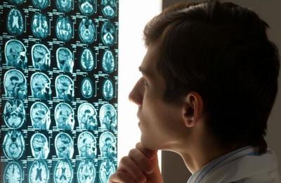 El coronavirus podría envejecer el cerebro en 10 años y disminuir el coeficiente intelectual - C9N