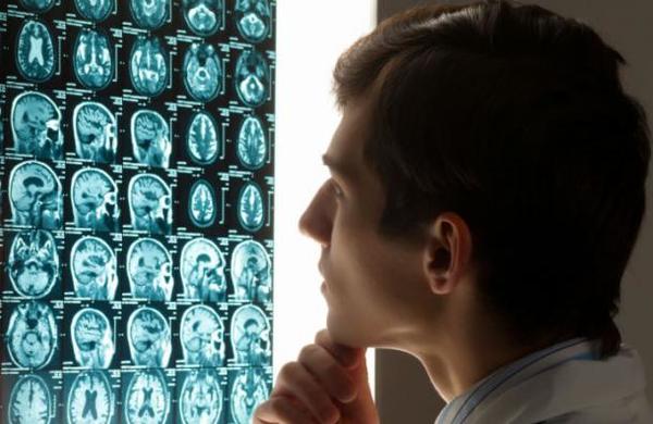 El coronavirus podría envejecer el cerebro en 10 años y disminuir el coeficiente intelectual - C9N