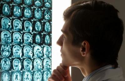 El coronavirus podría envejecer el cerebro en 10 años y disminuir el coeficiente intelectual - SNT