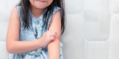 “Viviendo con psoriasis”, médicos y pacientes dan visibilidad a la enfermedad  - Nacionales - ABC Color