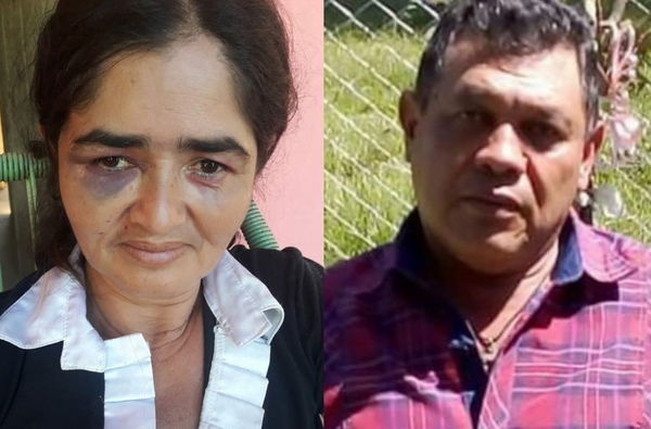 Mujer fue golpeada brutalmente por su ex pareja frente a sus hijos - Noticiero Paraguay