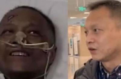 Médico chino al que se le oscureció la piel por un tratamiento contra el Covid-19 reapareció recuperado - SNT