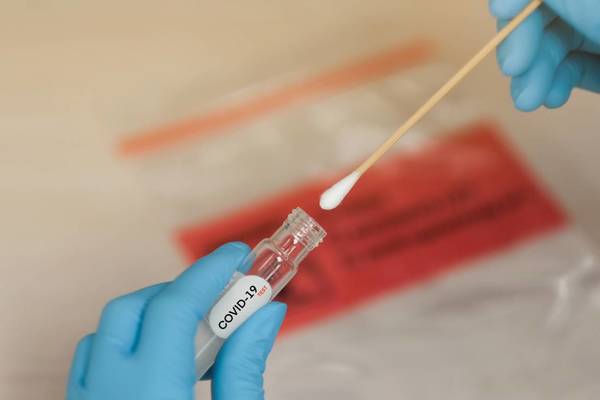 Ministerio de Salud adquirió 250 mil kits para pruebas rápidas de covid-19